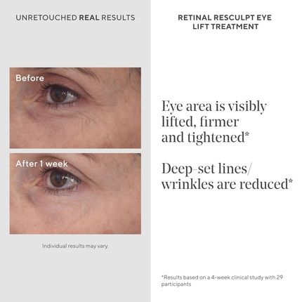 Murad Retinal Resculpt Eye Lift Treatment Resurgence Anti-Aging Eye Cream 0.5 Fl Oz - Image 3