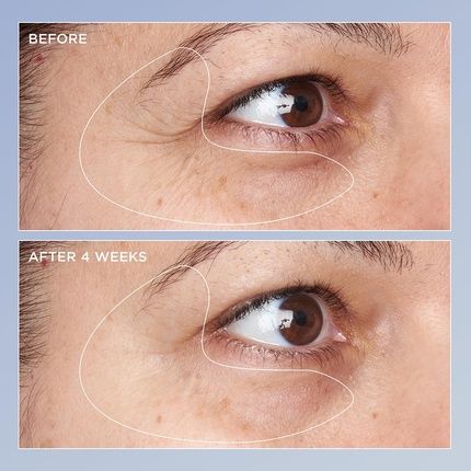 Perricone Md High Potency Triple Retinol Renewal Eye Serum 0.5 Fl Oz - Image 3