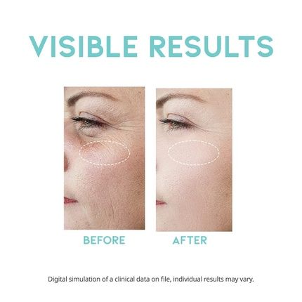 Retinol Serum For Face Anti-Aging 1.69 Fl Oz - Korean Formula - Image 3