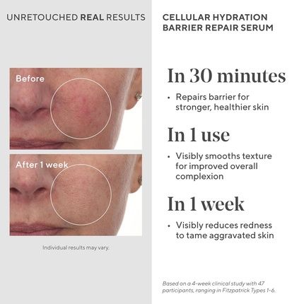 Murad Cellular Hydration Barrier Repair Serum Hydrating Face Serum Repairs Lipid-Depleted Skin Barrier Hexapeptide-9 Bilberry And Hyaluronic Acid Delivers Stronger Healthier Skin 1 Fl Oz 1 Ounce - Image 3