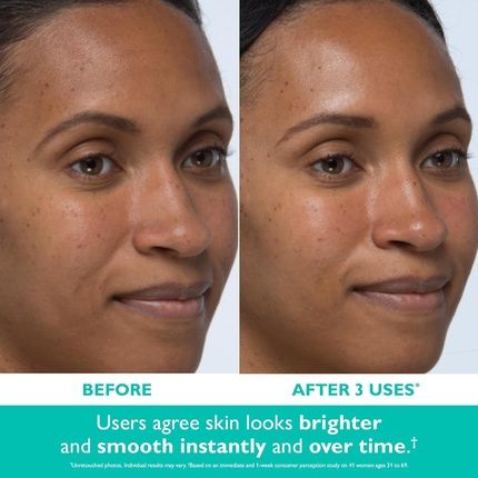 Peter Thomas Roth Even Smoother Instant Reveal Facial Peel Exfoliator - Image 3