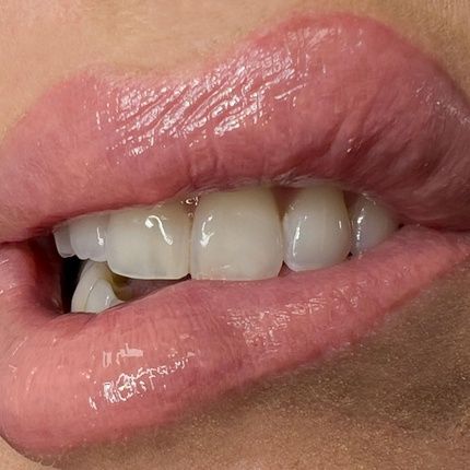 Glossami Gloss Peach Me - Image 3