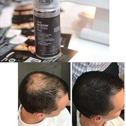 Hairfor2 Hair Thickening Spray Against Thinning Hair And Hair Powder