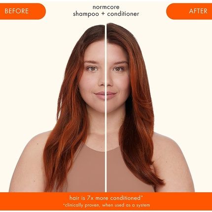 بلسم أميكا نورمكور سيجنتشر 1000 مل