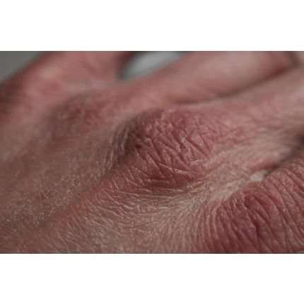 Laboratoire Du Haut-Segala Organic Prune Kernel Oil 50Ml - Image 3