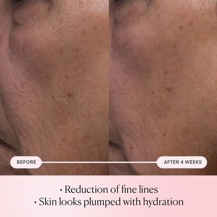 Elemis Pro-Collagen Rose Micro Serum Hydration Serum For Plumping, Soothing, And Nourishing Skin - Reduce Fine Lines And Wrinkles