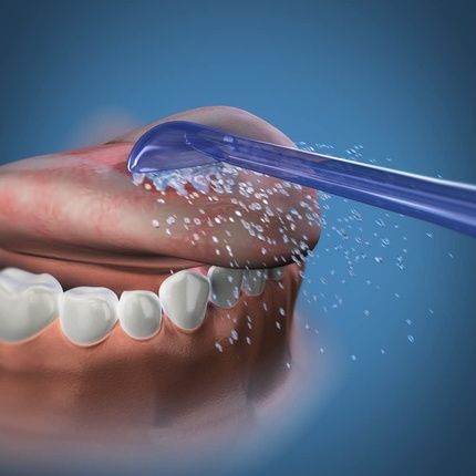 Waterpik Water Flosser Tongue Cleaner Replacement Tongue Scraper Tips For Fresh Breath - Image 3