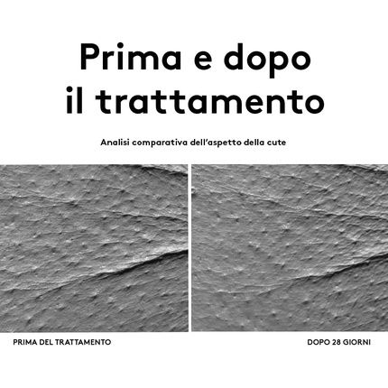 Korff Eye Zone Eye Contour Bags Glasses With Hyaluronic Acid And Vitamin Pp Anti-Wrinkle Moisturizer 15Ml - Image 3