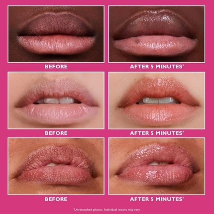 Peter Thomas Roth Instant Firmx Lip Filler Plumping Lip Treatment Enhances Volume Clinically Proven To Immediately Improve The Look Of Lip Plumpness And Lip Lines - Image 3