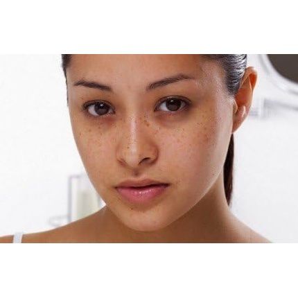 Acm Depiwhite Advanced Anti-Dark Spot Cream 40Ml