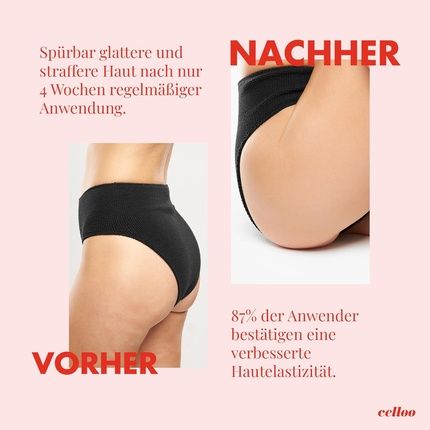 Celloo Anti-Cellulite Cream For Women 200Ml - Body Lotion For Dry Skin - Image 3