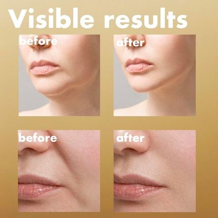 Isoi Intensive Lifting Serum Premium Hydrating Serum For Skin Elasticity - Image 3