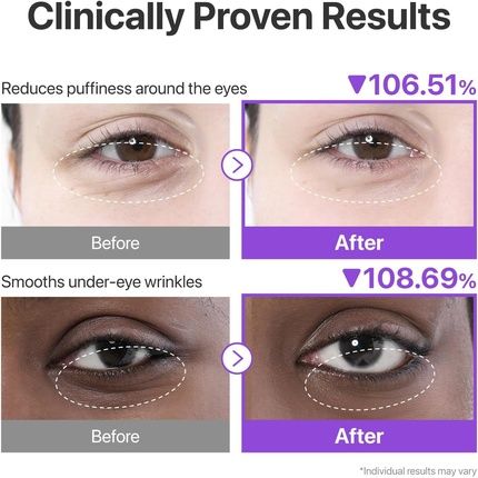 Numbuzin No.9 Collagen Under Eye Patches For Dark Circles - Image 3