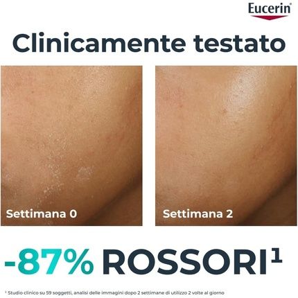 Eucerin Dermopure Clinical Hydra Repair Moisturizing Face Cream 40Ml