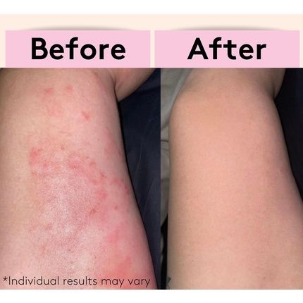 Delhicious Min-Tea Moisture Body Balm 100% Natural Moisturizer For Dry Skin Vegan & Plastic Free 70G - Image 3