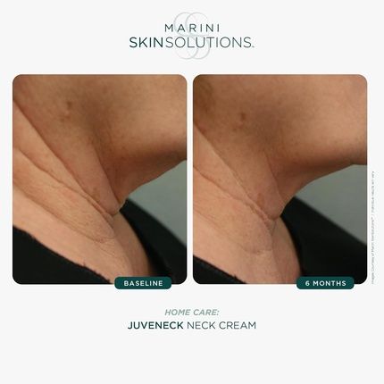 Marini Skinsolutions Juveneck Neck Cream For Hydration And Firmness