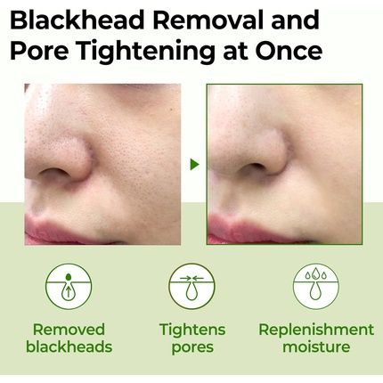 Some By Mi Super Matcha Pore Tightening Toner 5.07Oz 150Ml - Image 3