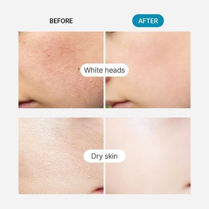 Tenzero Moisture Collagen Toner Pad 70Ea 100% Natural Cotton Hydrating - Image 3