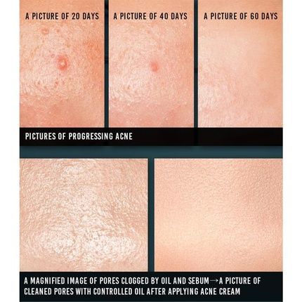 Pyunkang Yul Acne Cream 50Ml