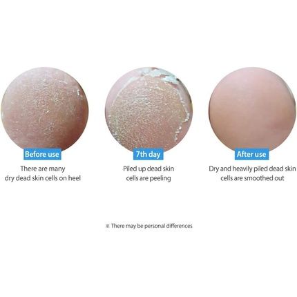 Frudia My Orchard Peach Foot Peeling Mask 40G - Image 3