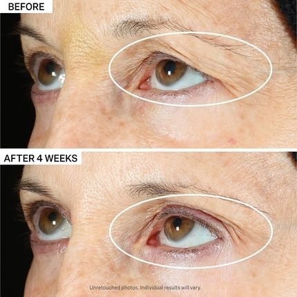 Strivectin Tighten & Lift Peptight 360 Degree Eye Serum 1 Fl Oz - Peptides For Wrinkles, Bags, And Puffiness
