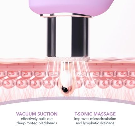 Foreo Kiwi Derma Microdermabrasion Machine Whitehead & Blackhead Remover Tool Lavender - Image 3