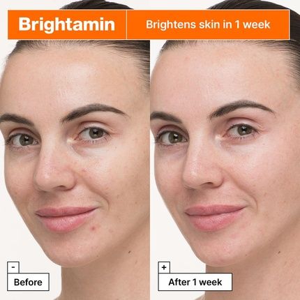 Dr.Jart+ Brightamin Brightening Serum For Visible Fine Lines With Vitamin C - Image 3
