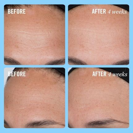 First Aid Beauty Firming Collagen Cream With Collagen, Peptides, And Niacinamide