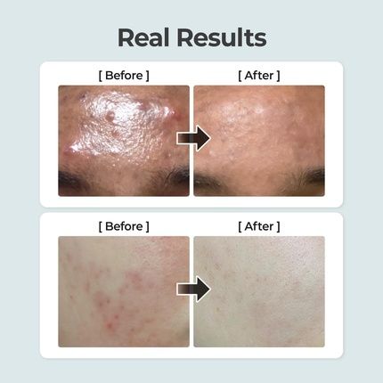 Numbuzin No.1 Pure Full Calming Herb Toner For Acne-Prone Skin With Centella Asiatica - Image 3