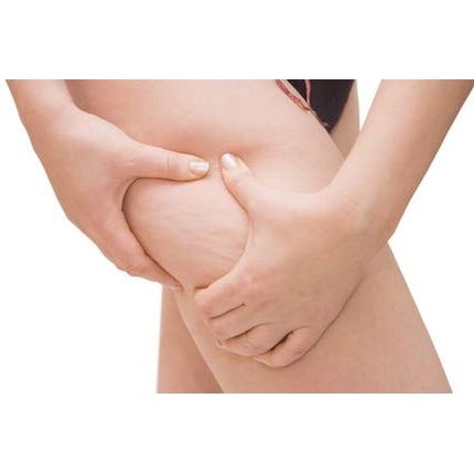 Bingospa Slim & Strong Modeling Body Gel With Centella, Caffeine, And Paprika