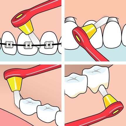Tepe Interspace Medium Brush With 12 Heads For Precision Cleaning - Image 3