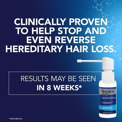 Regaine For Men Extra Strength Scalp Solution For Hair Regrowth 60Ml - Pack Of 3 - Image 3