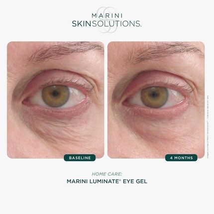 Marini Skinsolutions Luminate Eye Gel Reduces Appearance Of Dark Circles
