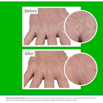 O'Keeffe'S Working Hands Eczema Relief Hand Cream 57G - Shea Butter - Image 3