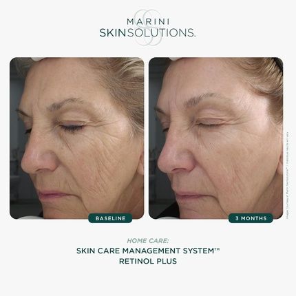 Marini Skinsolutions Retinol Plus Anti-Aging Face Lotion With Peptides