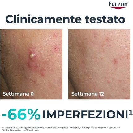 Eucerin Dermopure Clinical Triple Action Face Serum 40Ml