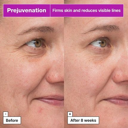 Dr.Jart+ Prejuvenation Firming Bakuchiol Serum For Preventative Aging - Anti-Aging Serum - Korean Skin Care - Image 3