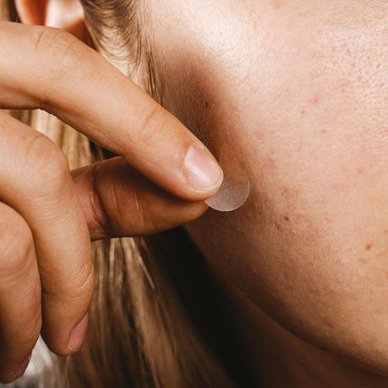 Anti-Pimple Patches