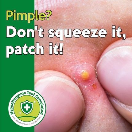 Troubless Micropoint Pimple Patch Acne Patches With Tea Tree - Image 3