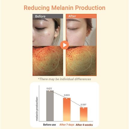 Heimish Rx Multi Vitamin Dark Spot Cream - Brightening Cream For Dark Spots - Image 3