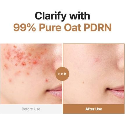 Purito Oat Pdrn Gentle Refining Toner 200Ml - Korean Oat Exfoliating