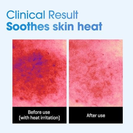 Some By Mi Beta-Panthenol Repair Daily Mask 30 Sheets 11.8Oz - Image 3