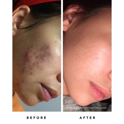 Herbivore Botanicals Organic Blue Tansy Resurfacing Mask - Image 3