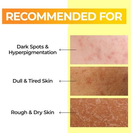 Numbuzin No.5 Toner Vitamin Boosting Essential Toner First Step Skin Care - Image 3