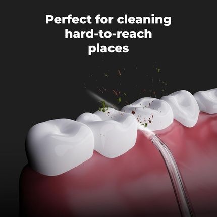 فوهات Adin2 لري الأسنان Aeno Adi0002 - 3 أنواع