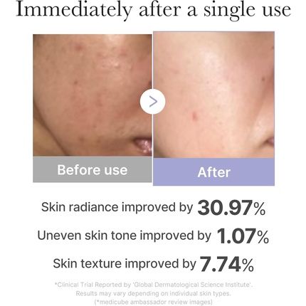 Medicube Booster Pro Mini White Affordable At-Home Facial Skin Care Tool - Image 3