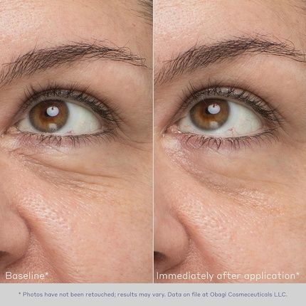 Obagi Daily Hydro-Drops Rejuvenating Eye Gel Cream - Image 3