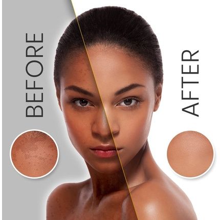 Makari Exclusive Facial Toning Gel 1.0Oz With Organiclarine Advanced Whitening & Toning Treatment - Image 3