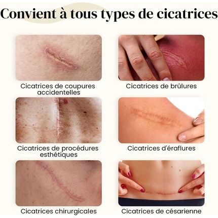 Dermatix Gel 60 Grams - Image 3