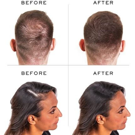 Nanogen Keratin Thickening Hair Fibres 15G Black - Image 3